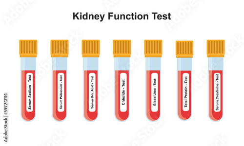 Kidney Function Blood Test Concept Design. Vector Illustration.
