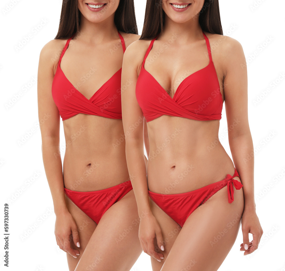 Breast augmentation with silicone implants. Collage with photos of woman in swimsuit before and after plastic surgery on white background, closeup Breast augmentation with silicone implants. Collage with photos of woman in swimsuit before and after plastic surgery on white background, closeup