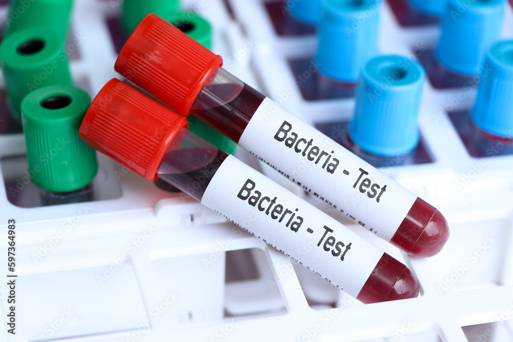 Bacteria test, blood sample to analyze in the laboratory Bacteria test, blood sample to analyze in the laboratory