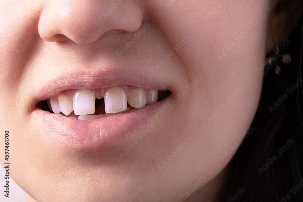 Close up of woman's open smiling mouth with gap teeht. Lips and unusual teeth Close up of woman's open smiling mouth with gap teeht. Lips and unusual teeth