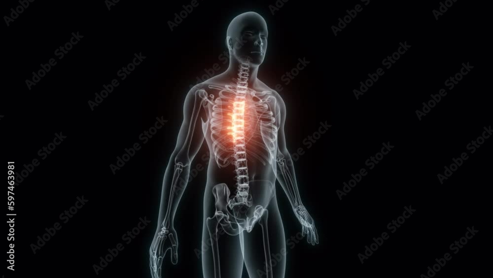 3D Rendering of a Medical Animation of the Spine ,Thoracic Vertebrae. X-ray of the Spine. 3D Rendering of a Medical Animation of the Spine ,Thoracic Vertebrae. X-ray of the Spine.