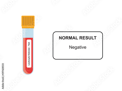 Leukocyte Esterase Blood Test Concept Design. Vector Illustration.