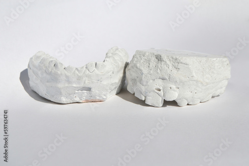 Obraz na plátně Dental casting gypsum model plaster cast stomatologic human jaws prothetic laboratory