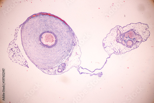Histological Spermatic cord human, Seminal vesicle human, Prostate human and Human chromosomes under the microscope for education.