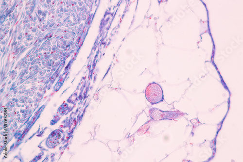 Histological Spermatic cord human, Seminal vesicle human, Prostate human and Human chromosomes under the microscope for education. photo