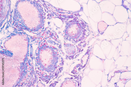 Histological Spermatic cord human, Seminal vesicle human, Prostate human and Human chromosomes under the microscope for education.