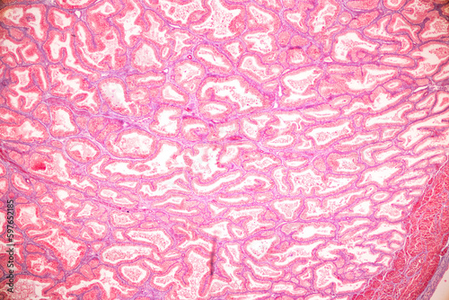 Histological Spermatic cord human, Seminal vesicle human, Prostate human and Human chromosomes under the microscope for education. photo