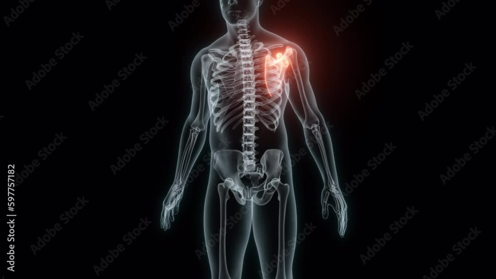 3D Rendering of a Medical Animation of the Scapula. X-ray of the Scapula. 3D Rendering of a Medical Animation of the Scapula. X-ray of the Scapula.