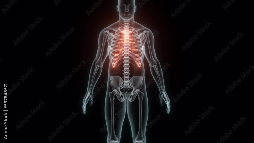 3D Rendering of a Medical Animation of the Rib cage. X-ray of the Rib cage. 3D Rendering of a Medical Animation of the Rib cage. X-ray of the Rib cage.