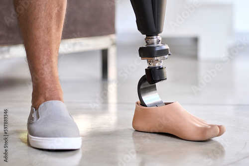 Man amputee with prosthetic leg disability on above knee transfemoral leg prosthesis artificial device stands on feet on floor, close up. People with amputation disabilities everyday life. photo