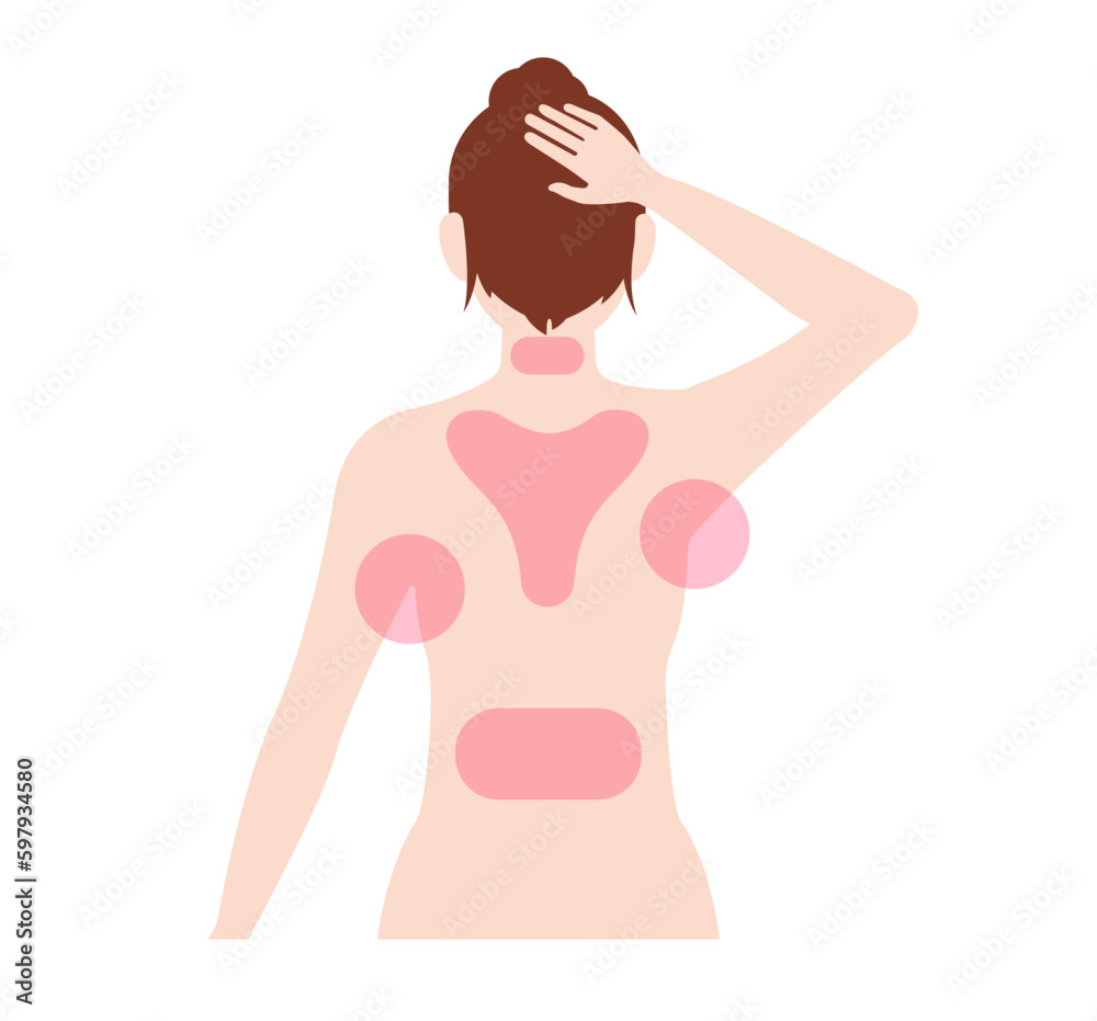 Locations with brown fat cells vector illustration Locations with brown fat cells vector illustration
