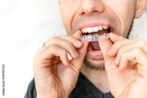 Unrecognizable man with beard putting on transparent dental retainer