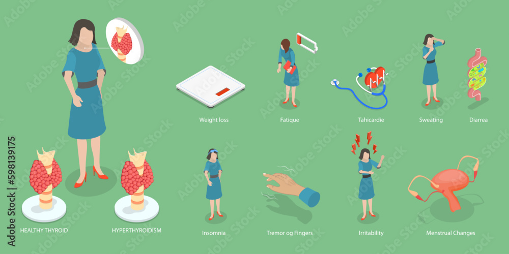 3D Isometric Flat Vector Conceptual Illustration of Hyperthyroidism Symptoms, Health and Medical Treatment