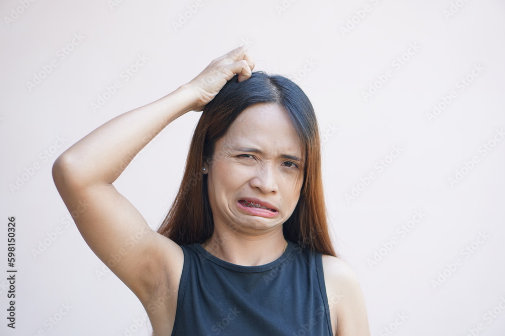 Asian woman having itchy head from dandruff. Asian woman having itchy head from dandruff.