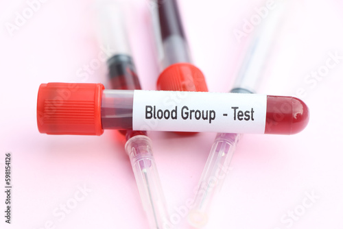 Blood Group test, blood sample to analyze in the laboratory