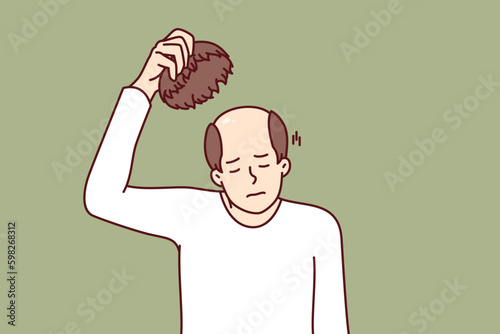 Man takes off wig and experiences stress of baldness caused by health problems or aging. Unhappy adult human with wig in hand needs hair transplant operation or drug to restore hair. Generative AI