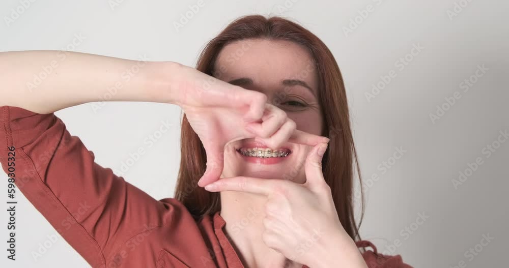 Young woman creates rectangle shape with her hands. Shows his braces, focuses on mouth, open hand wide. Concept on straight teeth, dentistry, orthodontics. Generative AI Young woman creates rectangle shape with her hands. Shows his braces, focuses on mouth, open hand wide. Concept on straight teeth, dentistry, orthodontics. Generative AI