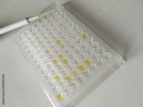 Enzyme-linked immunosorbent assay (ELISA), Immunology testing method in laboratory