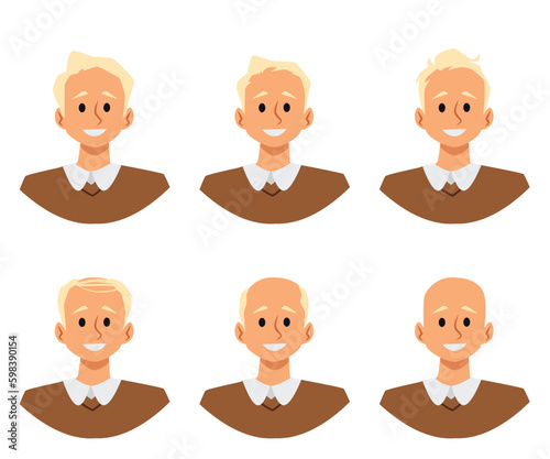 Alopecia stages and hair loss process, flat vector illustration isolated on white background.