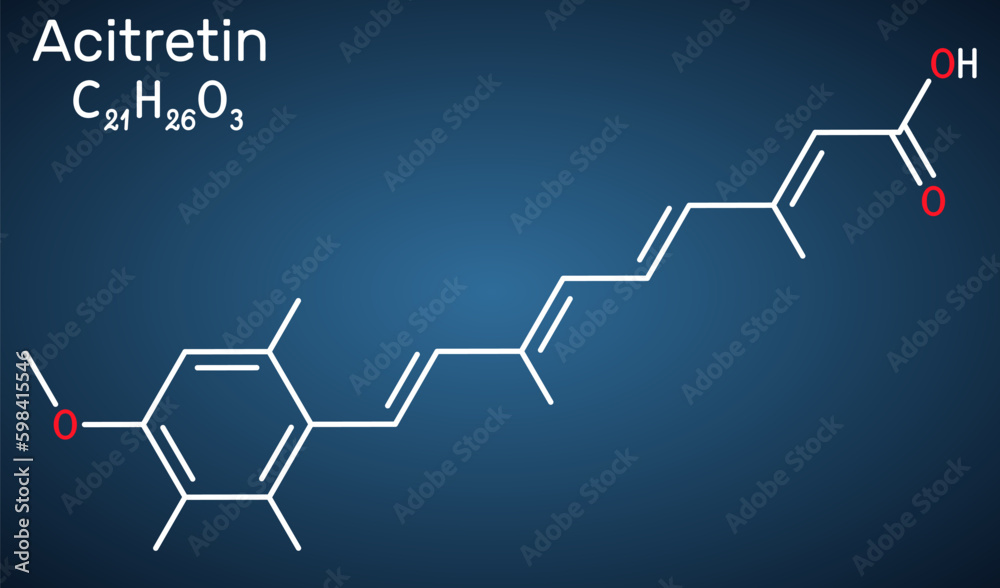 Acitretin molecule. It is retinoid used in the treatment of psoriasis. Structural chemical formula on the dark blue background. Acitretin molecule. It is retinoid used in the treatment of psoriasis. Structural chemical formula on the dark blue background.