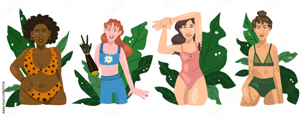 Set of women in underwear. Girls different nationalities with hyperpigmentation skin. Woman with a prosthesis on her arm. Happy body positive girls isolated on white background. Vector Generative AI