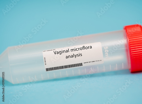Vaginal microflora analysis