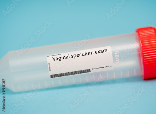 Vaginal speculum exam photo