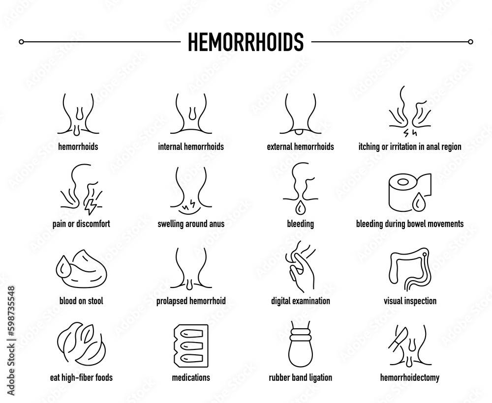 Haemorrhoids symptoms, diagnostic and treatment vector icon set. Line editable medical icons.
