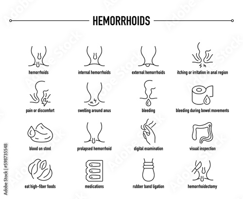 Haemorrhoids symptoms, diagnostic and treatment vector icon set. Line editable medical icons.