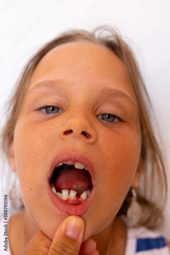 Vertical cropped dentist hand hold open little girl toothless mouth ...