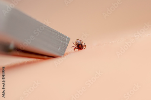 Obraz na płótnie The tick is removed with tweezers from the baby's skin
