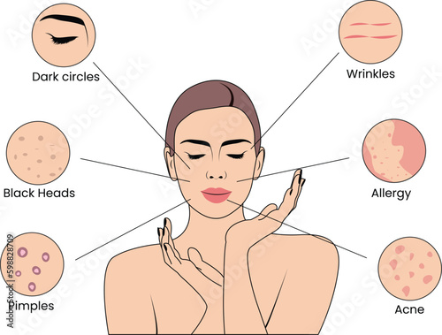 Vector Art Depicting Various Skin Issues, Vector-Based Guide to Skin Problems, Illustrated Vector Guide to Skin Conditions