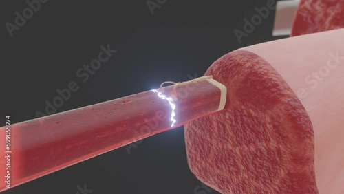 Muscle Cell and Action Potential Transmission photo