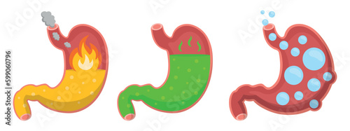 Set of different conditions of the stomach in cartoon style. Vector illustration of stomach with different conditions: bloating, heartburn, gas and high acidity isolated on white background.