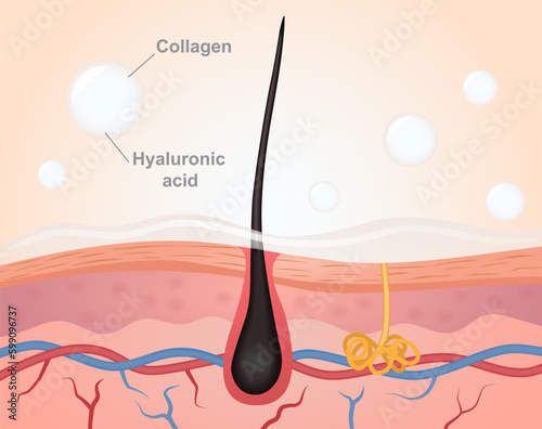 Collagen and hyaluronic acid