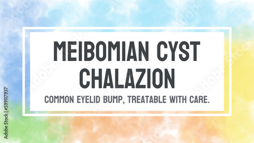 Meibomian Cyst Chalazion - Inflammation of the eyelid caused by a blocked gland.