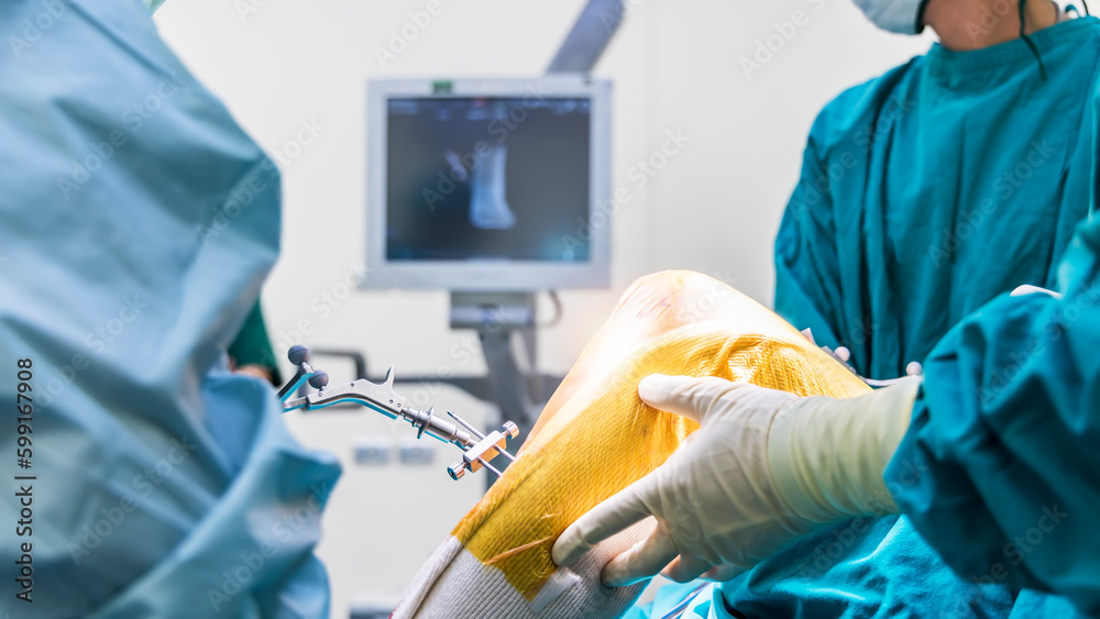 Doctor or surgeon in blue gown used robotic navigator total knee joint