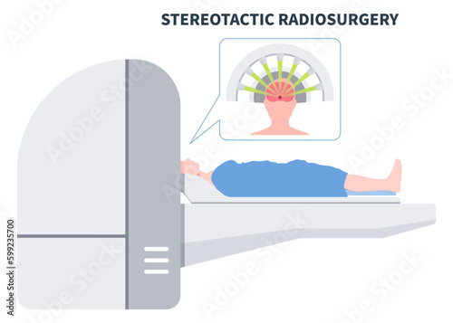 Radiosurgery X-ray and MRI imaging scan Gamma tumor cancer treat exam body medicine focus disease accelerator central nervous system beam of CT Linac linear particle Knife minimally invasive oncology
