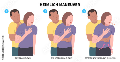 Choking first aid baby food CPR child step lodges blocking victim adult help abdomen kids conscious poster swallow back Heimlich maneuver blows chest rescue breath care safety