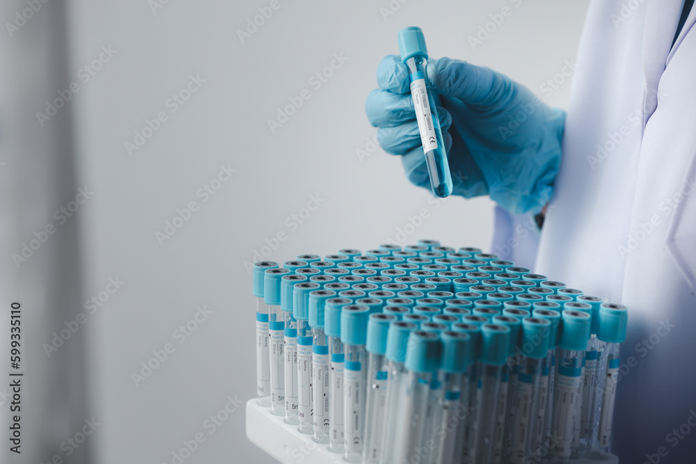 Lab assistant, a medical scientist, a chemistry researcher holds a glass tube through the blood sample, does a chemical experiment and examines a patient's blood sample. Medicine and research concept. Lab assistant, a medical scientist, a chemistry researcher holds a glass tube through the blood sample, does a chemical experiment and examines a patient's blood sample. Medicine and research concept.