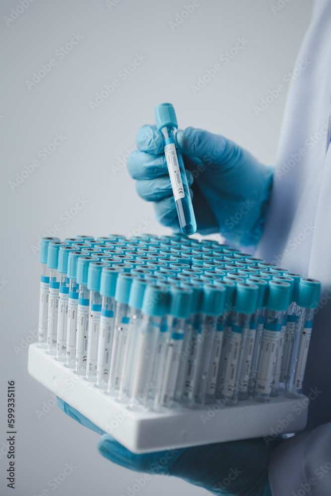 Lab assistant, a medical scientist, a chemistry researcher holds a glass tube through the blood sample, does a chemical experiment and examines a patient's blood sample. Medicine and research concept. Lab assistant, a medical scientist, a chemistry researcher holds a glass tube through the blood sample, does a chemical experiment and examines a patient's blood sample. Medicine and research concept.