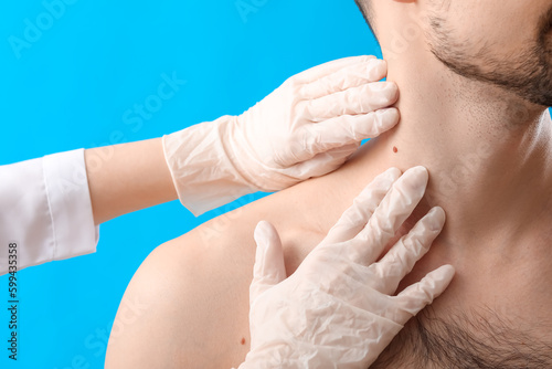 Dermatologist examining mol...