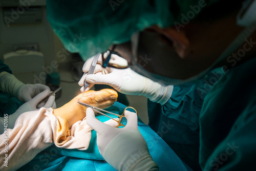 Hand of doctor or surgeon did foot surgery inside an operating room in the hospital.People in green gown used medical tools to suture the surgical wound.Foot and toe surgery of bunion.Light effect.