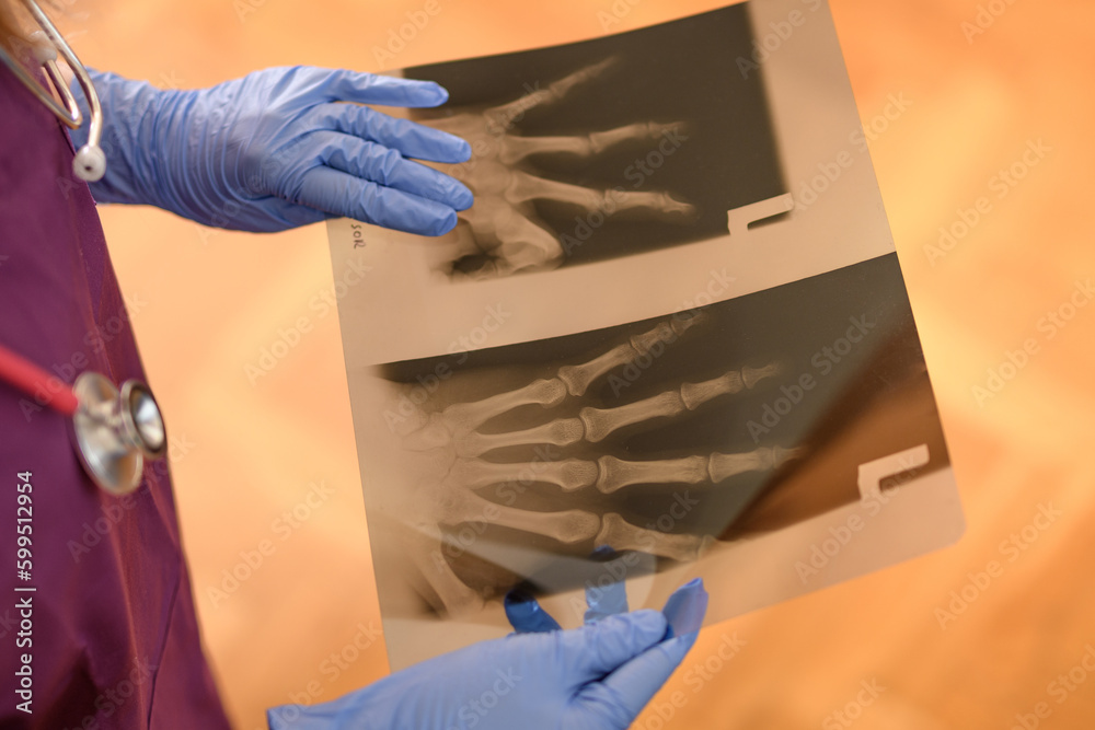 Zdjęcie rentgenowskie  - obrazy, fototapety, plakaty 