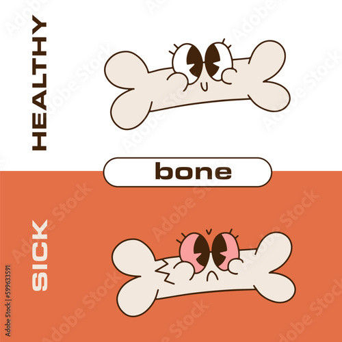 Cute bone retro cartoon character. Healthy happy bone and sick sad unhealthy osteoporotic, fracture. Linear hand drawn Illustration in trendy 90s-00s style.
