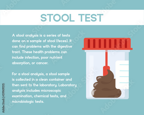 Flat design of stool test for medical and healthcare.  Stool test poster. Illustration for websites, landing pages, mobile applications, posters and banners. Trendy flat vector illustration