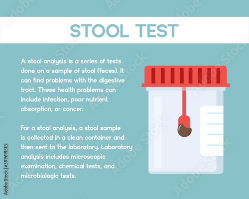 Flat design of stool test for medical and healthcare.  Stool test poster. Illustration for websites, landing pages, mobile applications, posters and banners. Trendy flat vector illustration