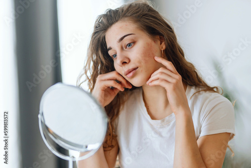 Fototapeta Young woman  with problem skin looking into mirror