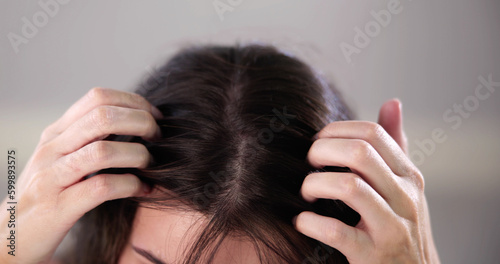 Hair Dandruff And Itchy Scalp Problem