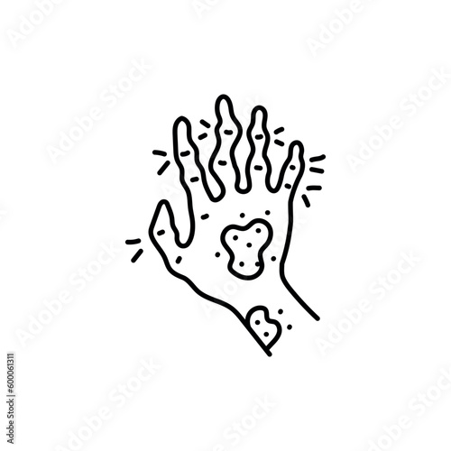 Rheumatoid arthritis black line icon. Autoimmune diseases
